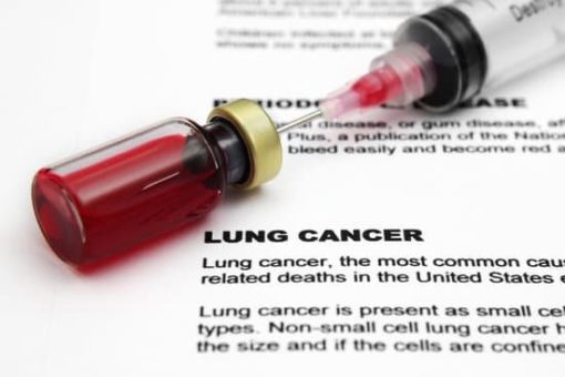 : Cromos Pharma supporting lung cancer clinical trials