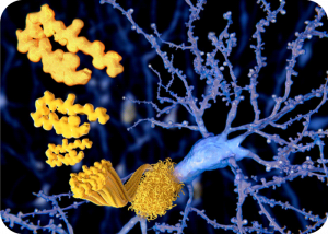 Alzheimer's Disease Transmission Confirmed in Living Individuals | Cromos Pharma