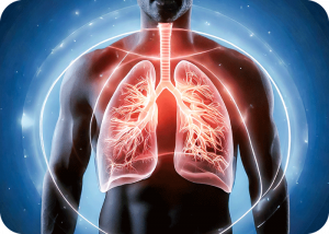 Transforming Lung Cancer Care: New Insights Unveiled | Cromos Pharma