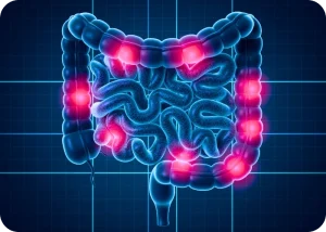 New Breakthrough in BRAF-Mutant Colorectal Cancer Treatment | Cromos Pharma