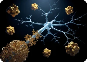 Alzheimer's Disease Transmission Confirmed in Living Individuals | Cromos Pharma